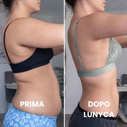Confronto fotografico 'Prima' e 'Dopo' l'utilizzo del trattamento Lunyca. La foto di sinistra, etichettata come 'PRIMA', mostra il profilo laterale di una donna con accumuli adiposi e gonfiore nella zona addominale e della schiena. La foto di destra, etichettata come 'DOPO LUNYCA', mostra la stessa persona con un addome visibilmente più piatto, una silhouette più definita e una riduzione del gonfiore cutaneo.