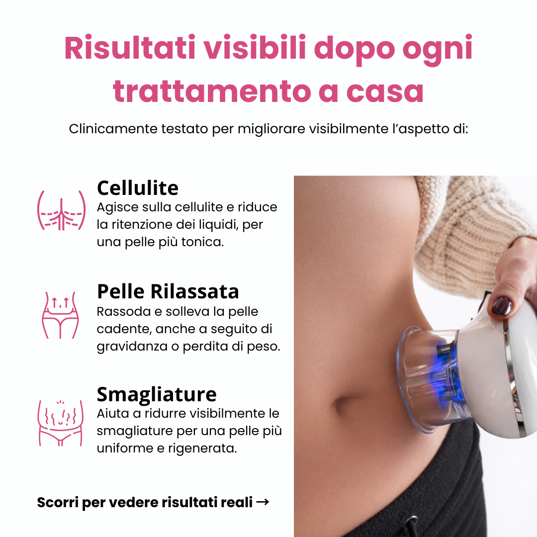 Infografica che elenca i benefici clinici del massaggiatore Lunyca per l'uso domestico. Il testo evidenzia tre aree di azione principali: Cellulite, agendo sulla ritenzione dei liquidi per una pelle più tonica; Pelle Rilassata, per rassodare e sollevare la pelle cadente (anche post-gravidanza o perdita di peso); e Smagliature, per aiutare a ridurle visibilmente e rendere la pelle più uniforme. A destra, un'immagine ravvicinata mostra il dispositivo in funzione sull'addome di una donna